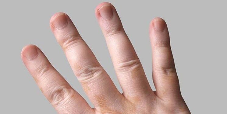 چگونه خشکی پوست را درمان کنیم؟