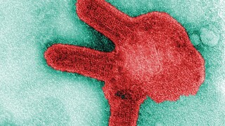 هشدار سازمان بهداشت جهانی از شیوع ویروس ناشناخته در آفریقا