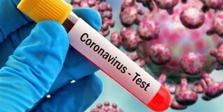 ۴۶بیمار جدید کووید۱۹ در کشور شناسایی شدند