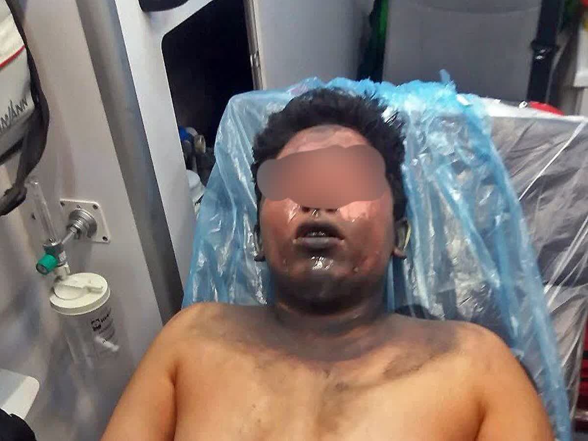 مجروح شدن یک نوجوان در حین ساخت ترقه در مشهد 