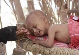 یونیسف: ۱۱ میلیون کودک در یمن نیاز به کمک دارند