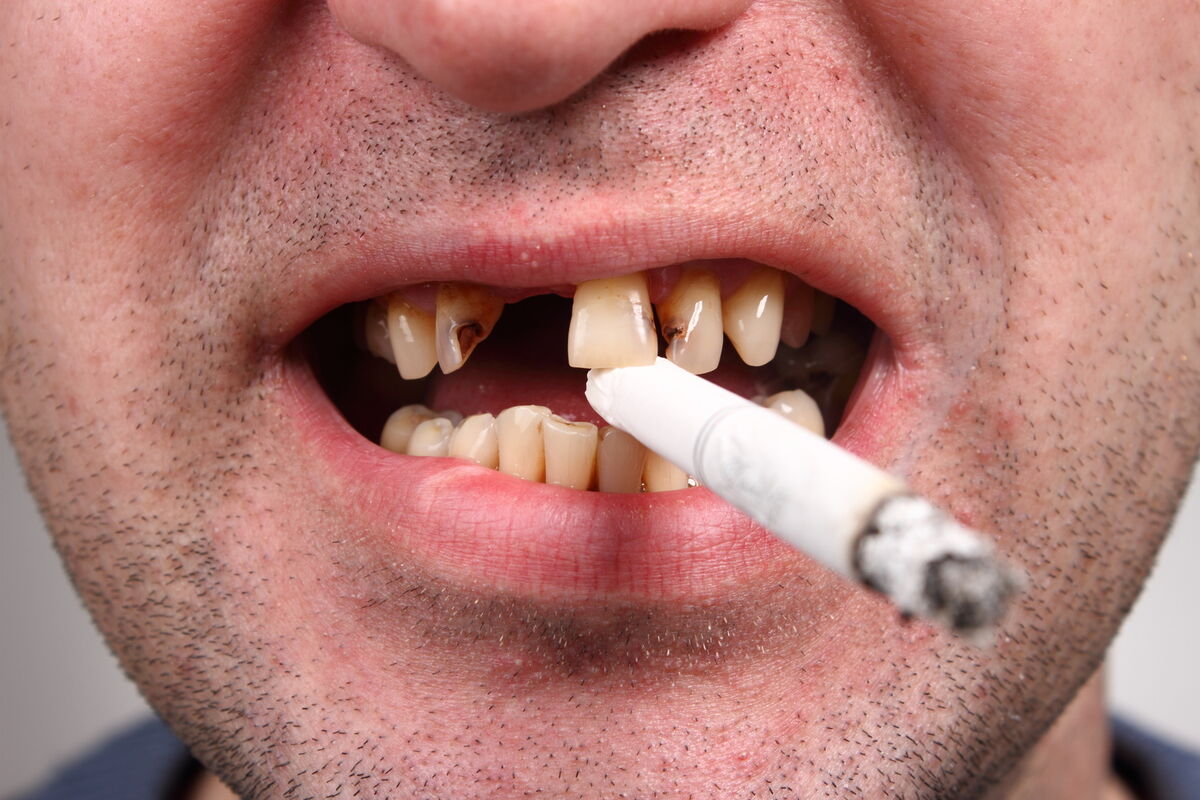 پشت پرده دندان های خرابِ ایرانی‌ها / تضاد منافع در وزارت بهداشت 