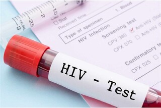 معاون مرکز تحقیقات ایدز ایران: درمان HIV رایگان و محرمانه است