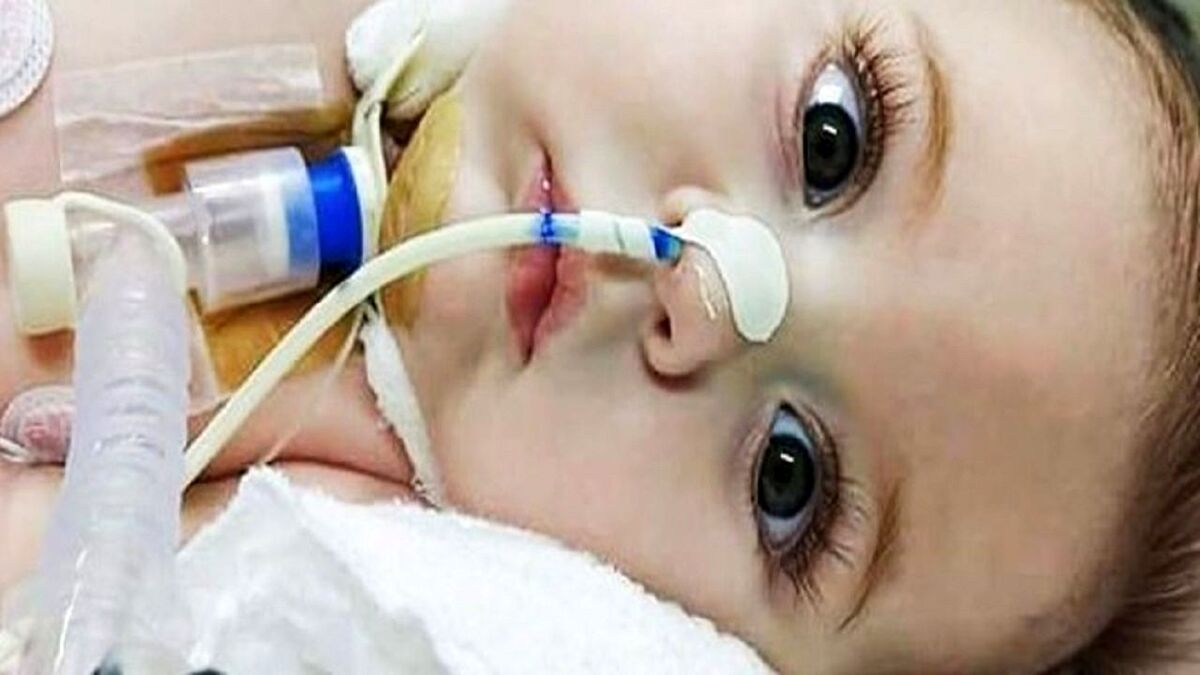 امید تازه برای بیماران سی‌اف / افزایش عمر بیماران به‌طور میانگین تا ۲۰ سال