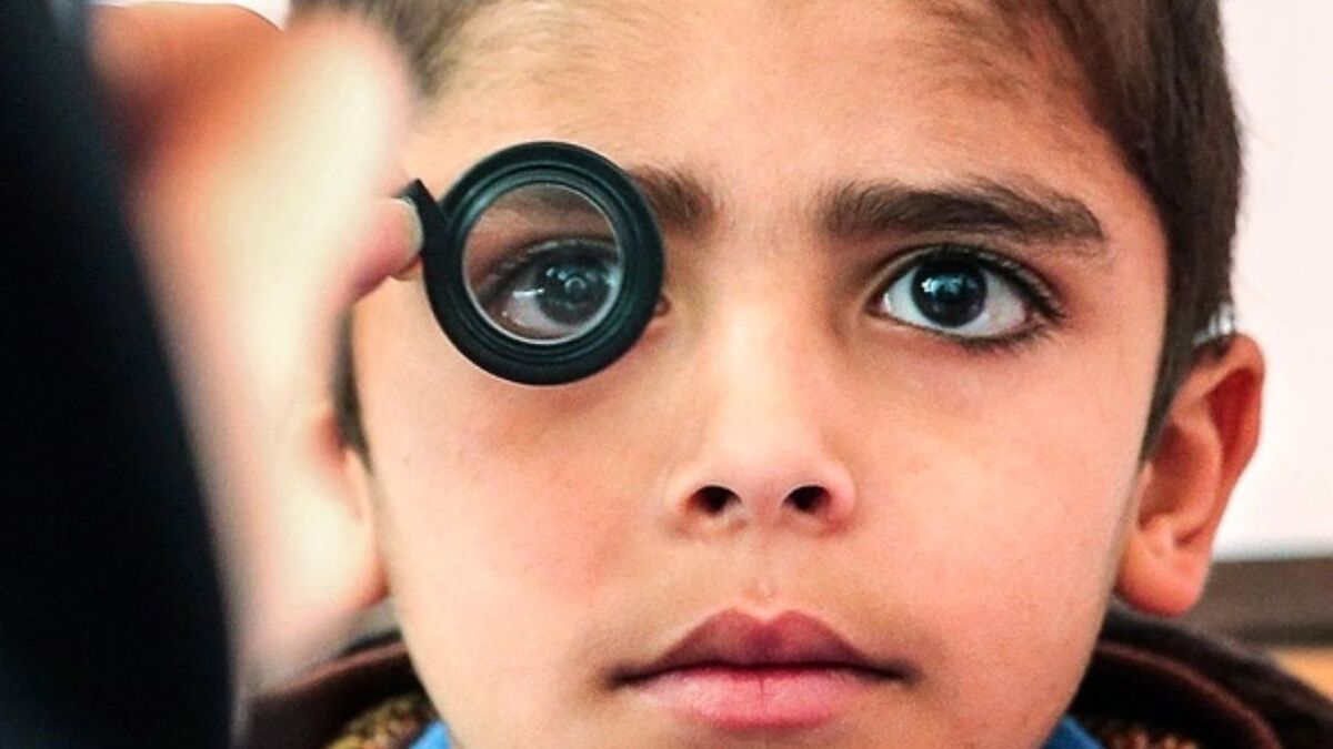 شناسایی بیش از ۱۹ هزار کودک دچار تنبلی چشم/ ۳۰۰۰ نوزاد دچار اختلال شنوایی 