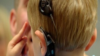 توزیع پردازشگر شنوایی برای ۲۶۰۰ بیمار نیازمند آغاز شد