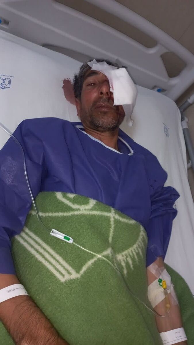 مصدومیت محیط بان تربت حیدریه پس از مواجهه با گراز