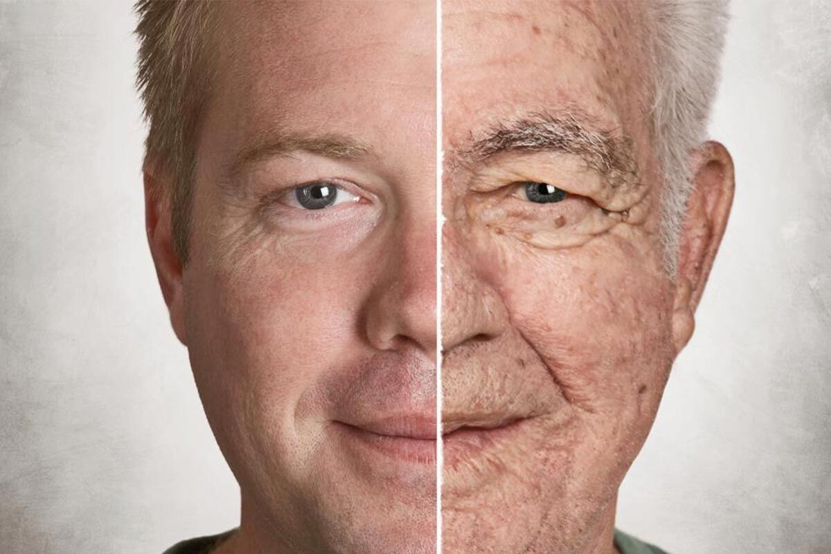 ۹ علت برای پیری زودرس پوست 
