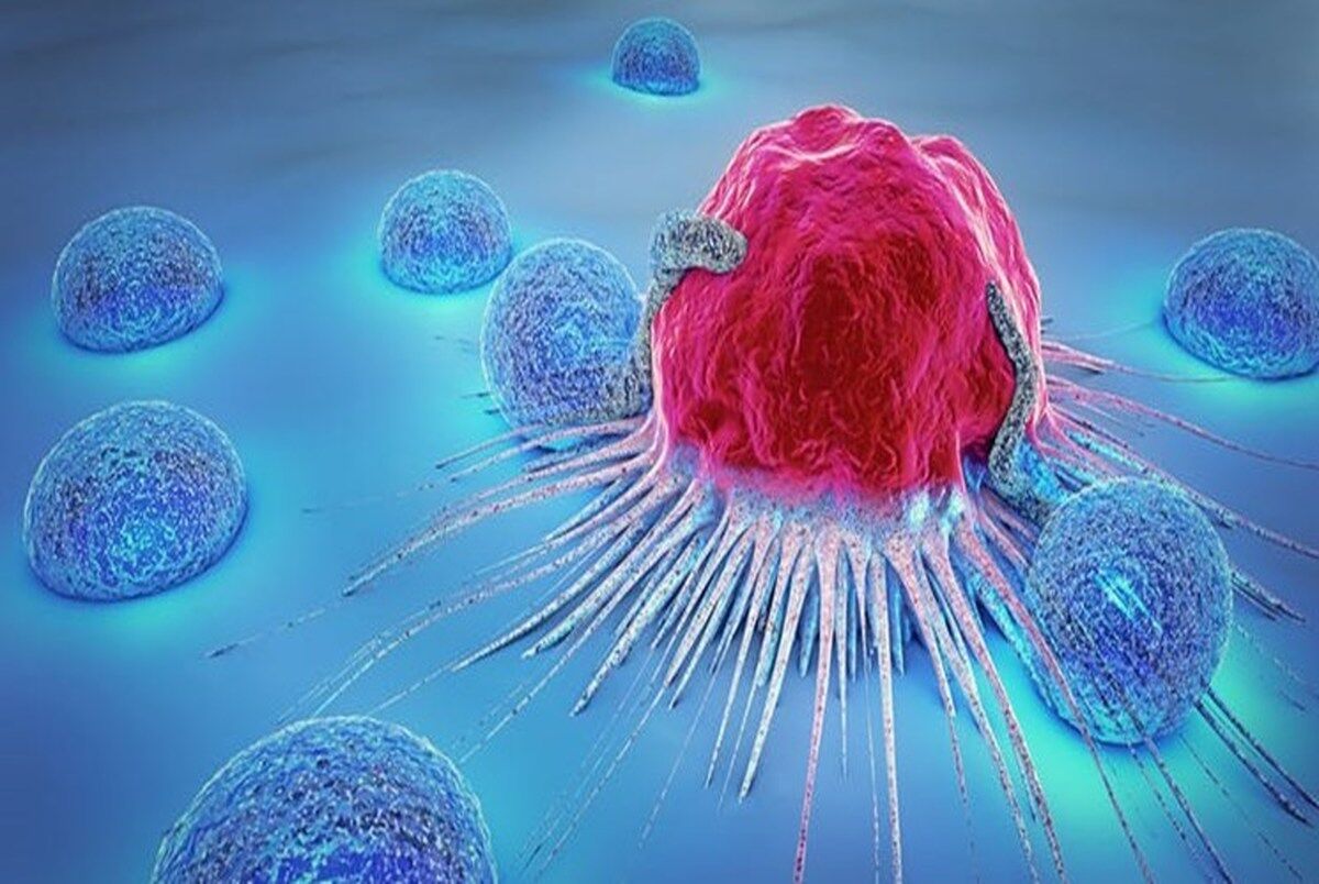 صرفه‌جویی ۲۰میلیون دلاری با تولید نانوکیت تشخیص سرطان روده در کشور