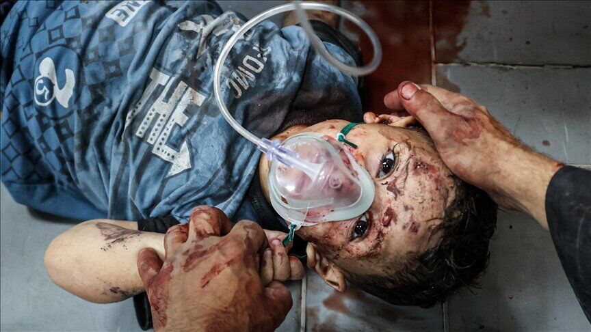 یونیسف: جراحت کودکان در جنگ غزه «وحشتناک» است