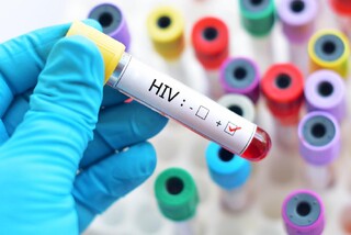 شناسایی  ۲۴۰۰۰ مبتلا به HIV در ایران