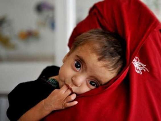 بحران گرسنگی؛ تهدیدی برای کودکان افغانستان در ۲۰۲۴