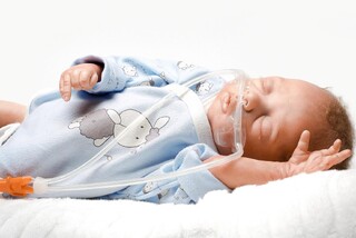 کووید بارداری احتمال بیماری تنفسی در نوزاد را ۳ برابر می کند