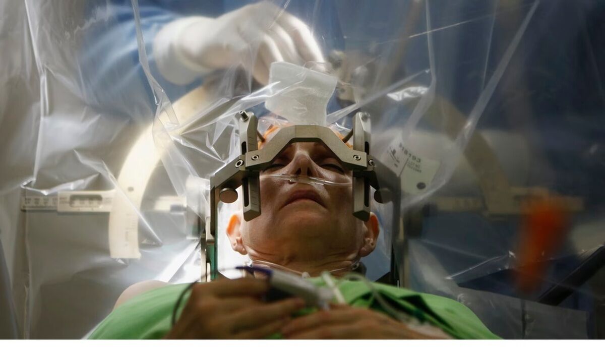 محققان پی بردند؛ تجمع آهن در مغز پس از ضربه مغزی