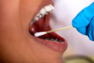 ارتباط بیماری‌های دهان و دندان با افت عملکرد قلب، مغز و بروز برخی سرطان‌ها
