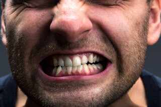 استرس پس از سانحه احتمال دندان قروچه را ۳ برابر می کند