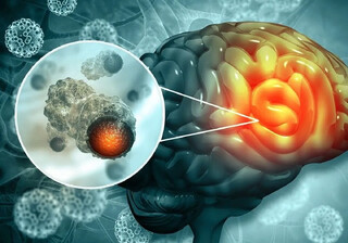 خبر خوب؛ تولید ویروسی برای درمان سرطان مغز توسط محققان ایرانی