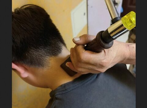 درمانهای ترسناک؛ از طب سوزنی روی زبان تا بادکش های داغ