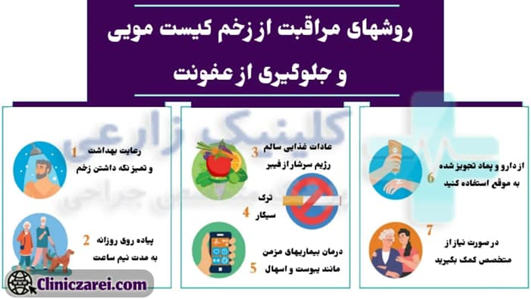 برای درمان کیست مویی چه کنیم؟