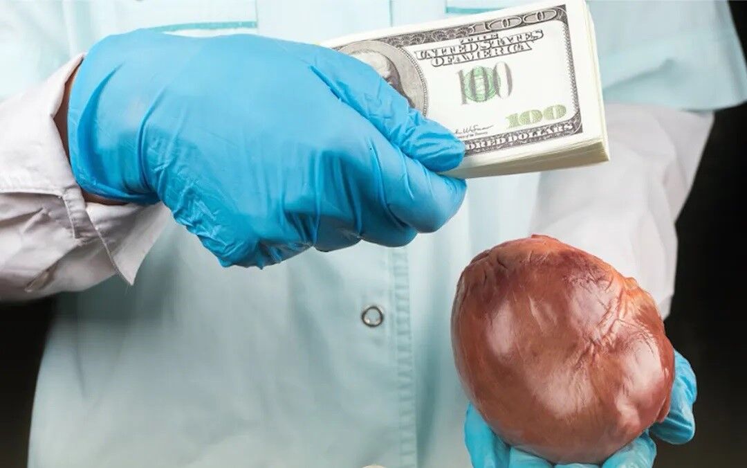 قربانیان گروههای تبهکار اعضای بدن/ قیمت هر کلیه چقدر است؟ قربانیان گروههای تبهکار اعضای بدن/ قیمت هر کلیه چقدر است؟