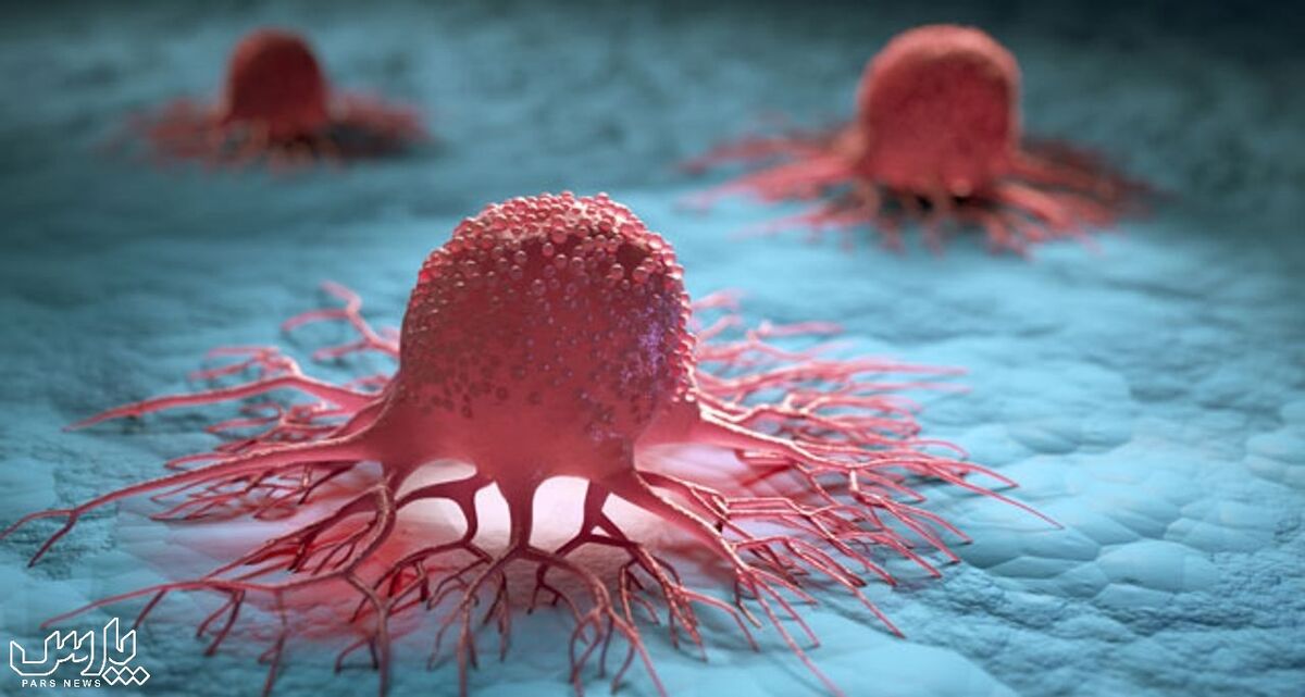 تشریح وضعیت شایع ترین سرطان در ایران