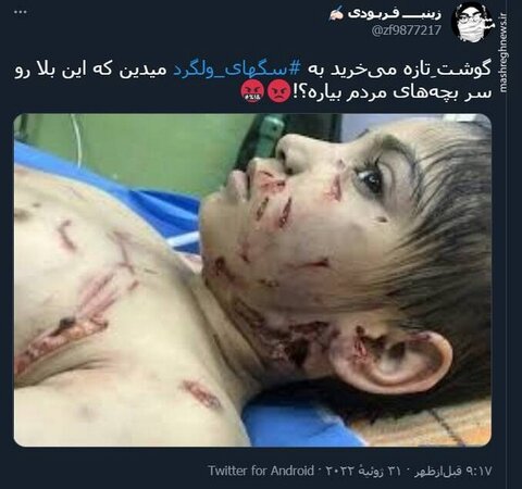 باز هم زخم کاریِ سگهای ولگرد بر بدن یک کودک نشست