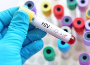 کاهش سهم اعتیاد تزریقی در انتقال HIV / برنامه‌های کاهش آسیب موفق بوده و نیازی به تغییر نیست
