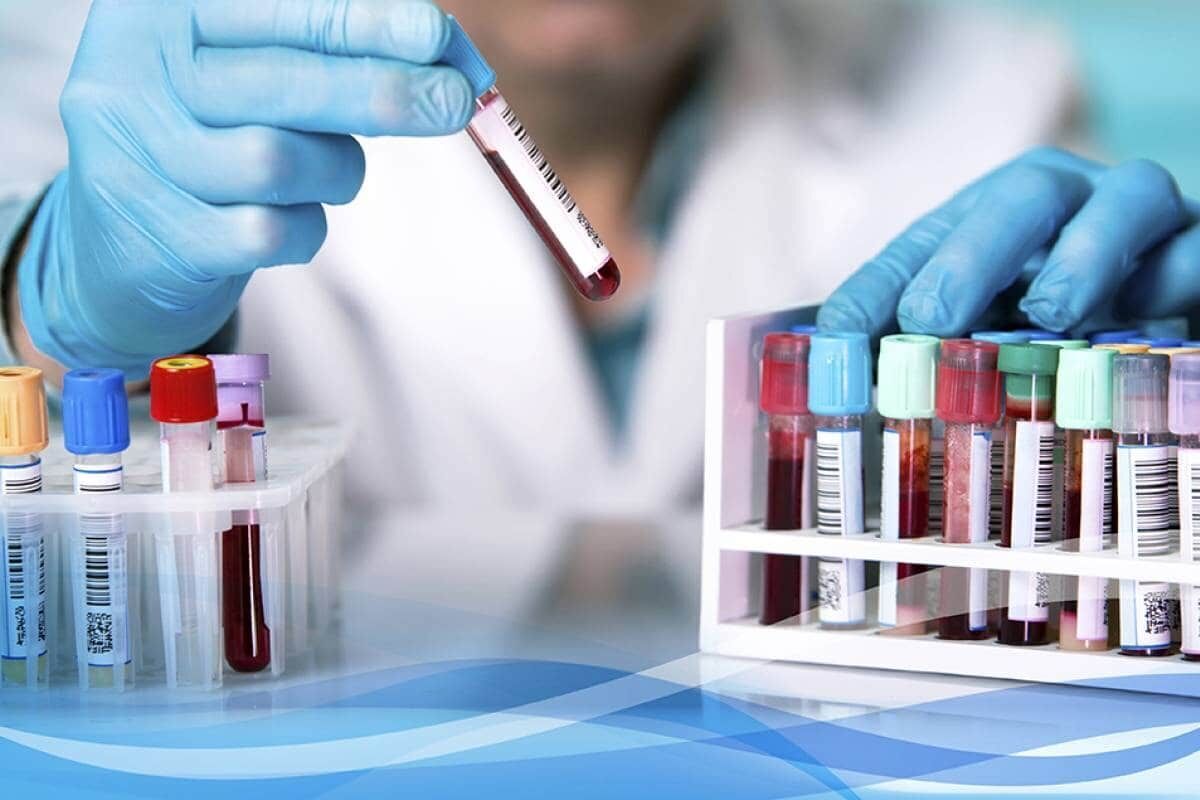 انتقاد یک کارشناسان و فعال علوم آزمایشگاهی؛ حضور رشته‌های متفرقه و غیرمجاز در آزمایشگاه‌ها