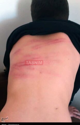 عکس | ضرب‌وشتم و شکنجه دانش‌آموزان توسط معلم در سنندج
