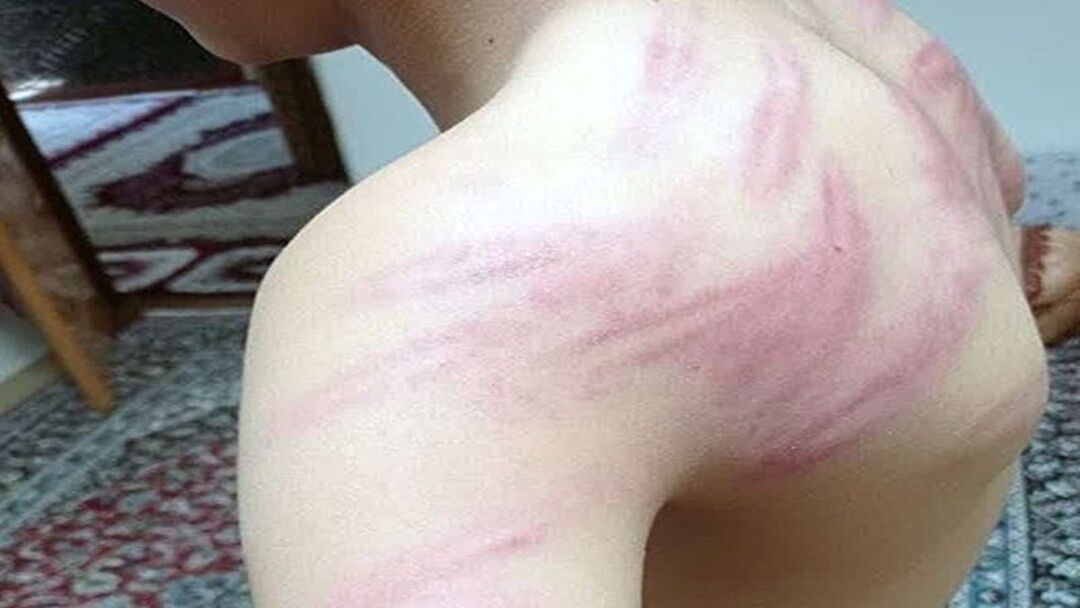 معلم خاطی سنندجی به دادسرا احضار شد