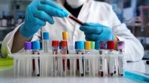 پوشش بیمه ای خدمات آزمایشگاهی در بخش خصوصی ضعیف است