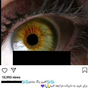 ورود پلیس فتا به تبلیغ عمل "تغییر رنگ چشم" و آمپول‌های لاغری