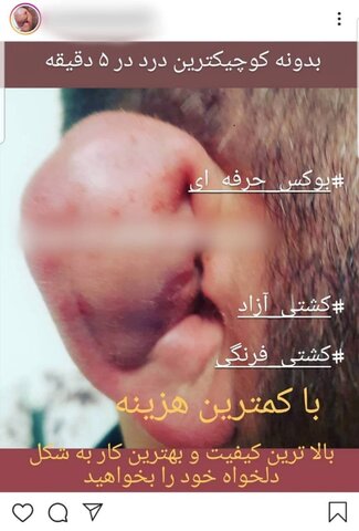 سفارش گوش گلکلمی؛ برای لات بازی یا خرید احترام خیابانی؟!