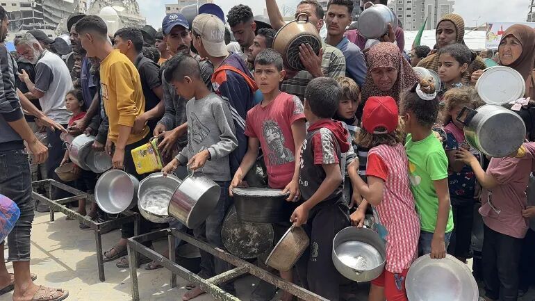 گرسنگی جان ۲۹۹ تن را در غزه گرفت/ سقط جنین ۳۰۰ زن باردار