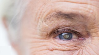 راه‌های پیشگیری از ابتلا به آب مروارید