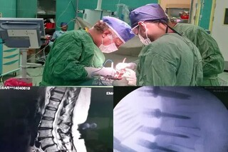 عمل موفقیت‌آمیز بیمار عراقی در بیرجند