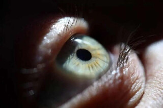 بازگشت بینایی پس از ۲۰ سال با جراحی  «دندان در چشم»!