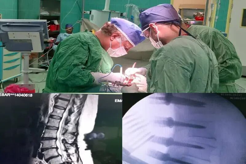 عمل موفقیت‌آمیز بیمار عراقی در بیرجند