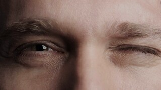 فیلم | چرا دچار تیک عصبی می‌شویم؟