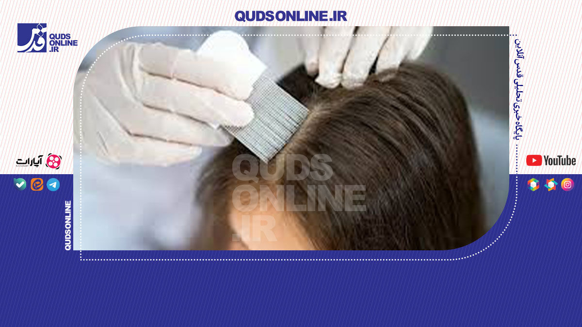 فیلم | تشخیص اضطراب و افسردگی کودک با آزمایش مو