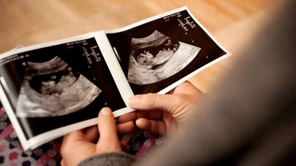 وزارت بهداشت آیین‌نامه اهدای جنین را سریع‌تر نهایی کند