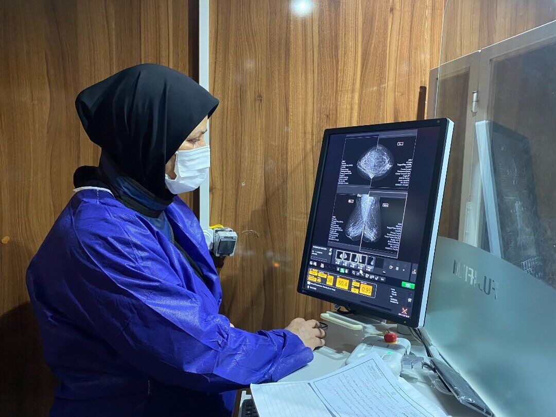 آغاز «ماموگرافی رایگان» در سراسر کشور از ۲۶ مهر + اسامی مراکز