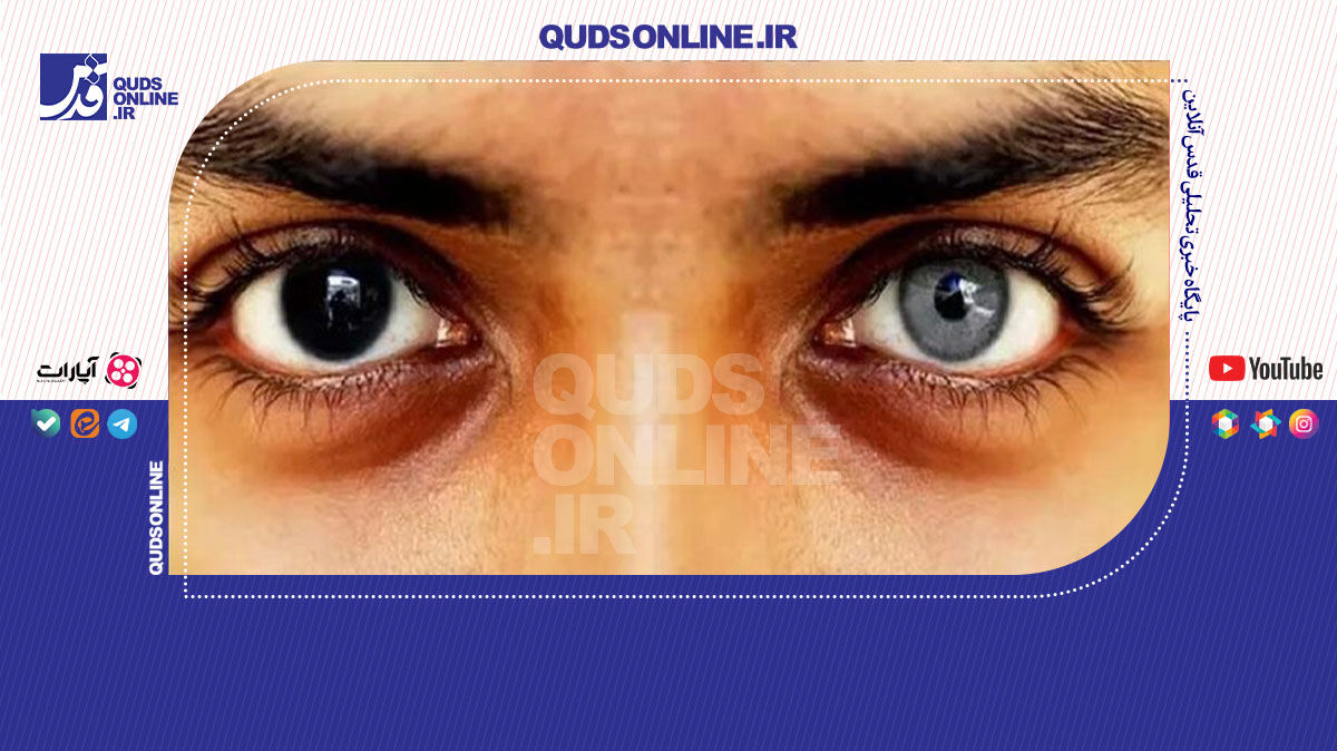 فیلم | انجام عمل تغییر رنگ چشم ممنوع است