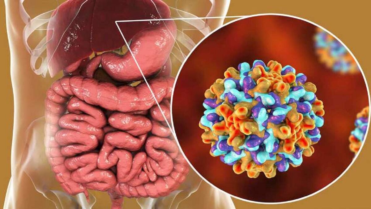 هشدار شیوع بالای هپاتیت A در کودکان و نوجوانان ایرانی