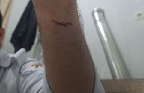 حمله به امدادگر اورژانس ۱۱۵ در کردستان توسط فرد بیمارنما