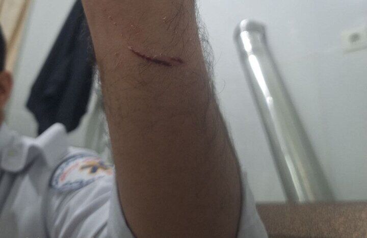 حمله به امدادگر اورژانس ۱۱۵ در کردستان توسط فرد بیمارنما