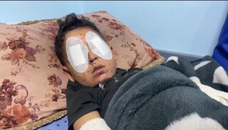 غزه در آستانه شب کوری جمعی