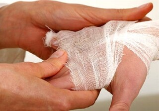 بستری سالانه ۳۰هزار نفر بر اثر سوختگی در کشور/ باورهای غلط مانع درمان به موقع بیماران