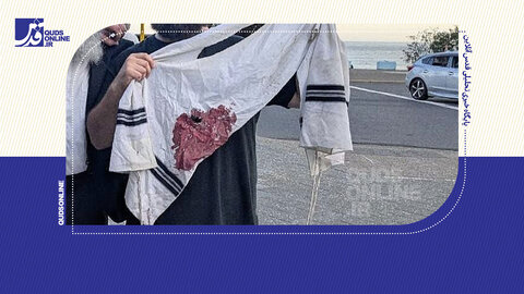 هلاکت ۱۰ صهیونیست در جشن حانوکای در استرالیا