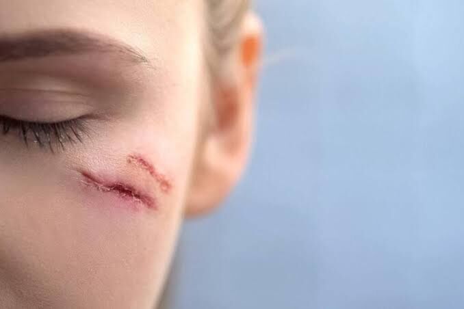 فریاد خاموش پوست انسان